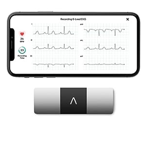 KardiaMobile 6L, six-lead ekg, heart monitor